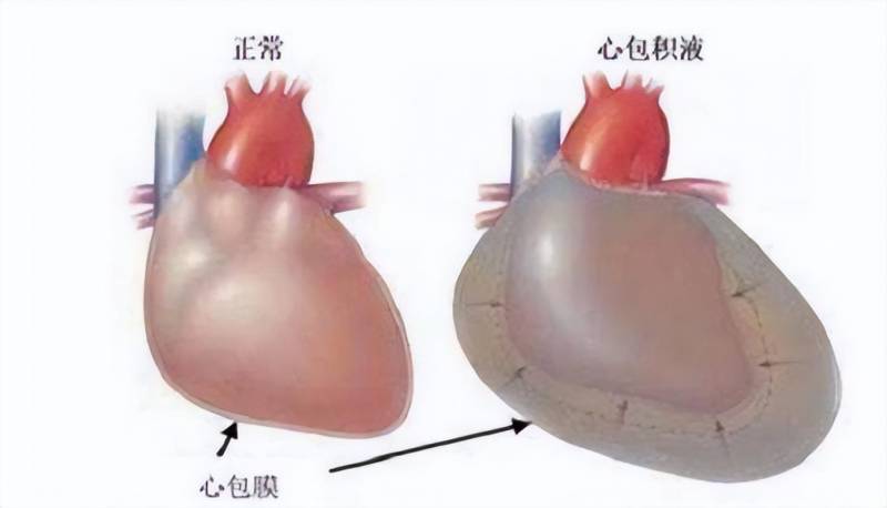 奇脉的原理，探秘不一样的脉搏韵律