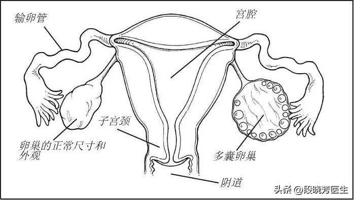 脸上竟然这么多毛，女生面部多毛简易解决法