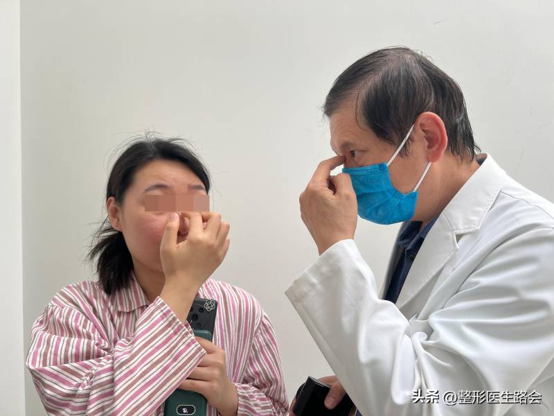北京隆鼻哪个医院好？30岁江苏跑北京做了膨体隆鼻，4个月后怼脸实拍，恢复成了这样！