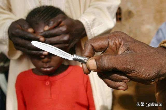 在非洲女性割礼，一种文化习俗与国际争议