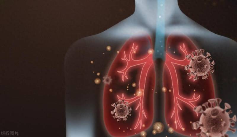 什么是间质性肺炎？深入了解其症状与影响