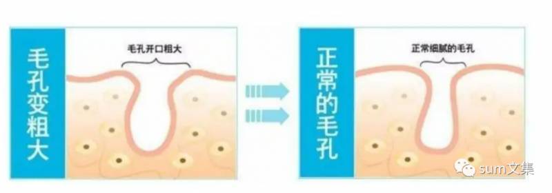 光滑肌的养成，告别粗大毛孔，拥抱细腻美肌