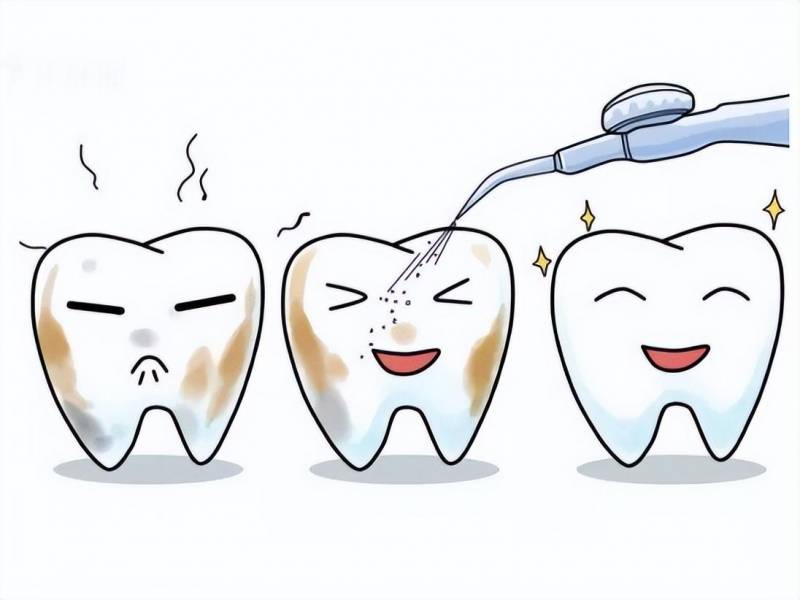 明星的牙为什么那么白，与普通人牙齿颜色差异的原因分析